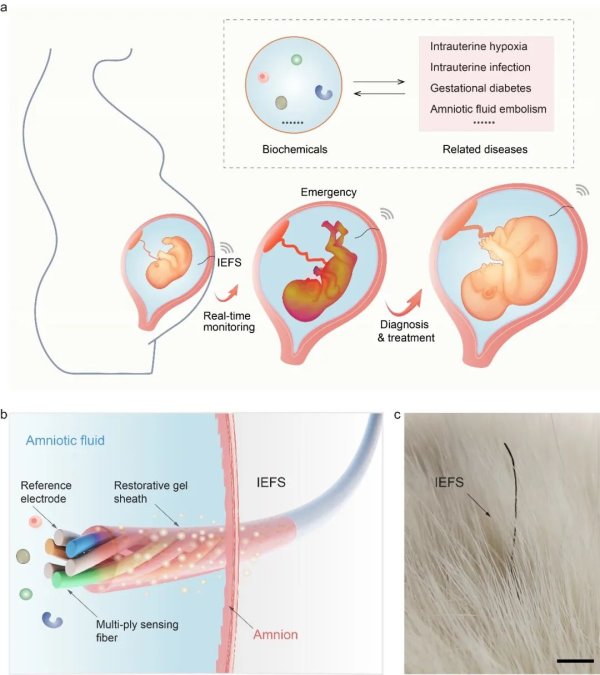用于实时监测妊娠期羊水的纤维传感器